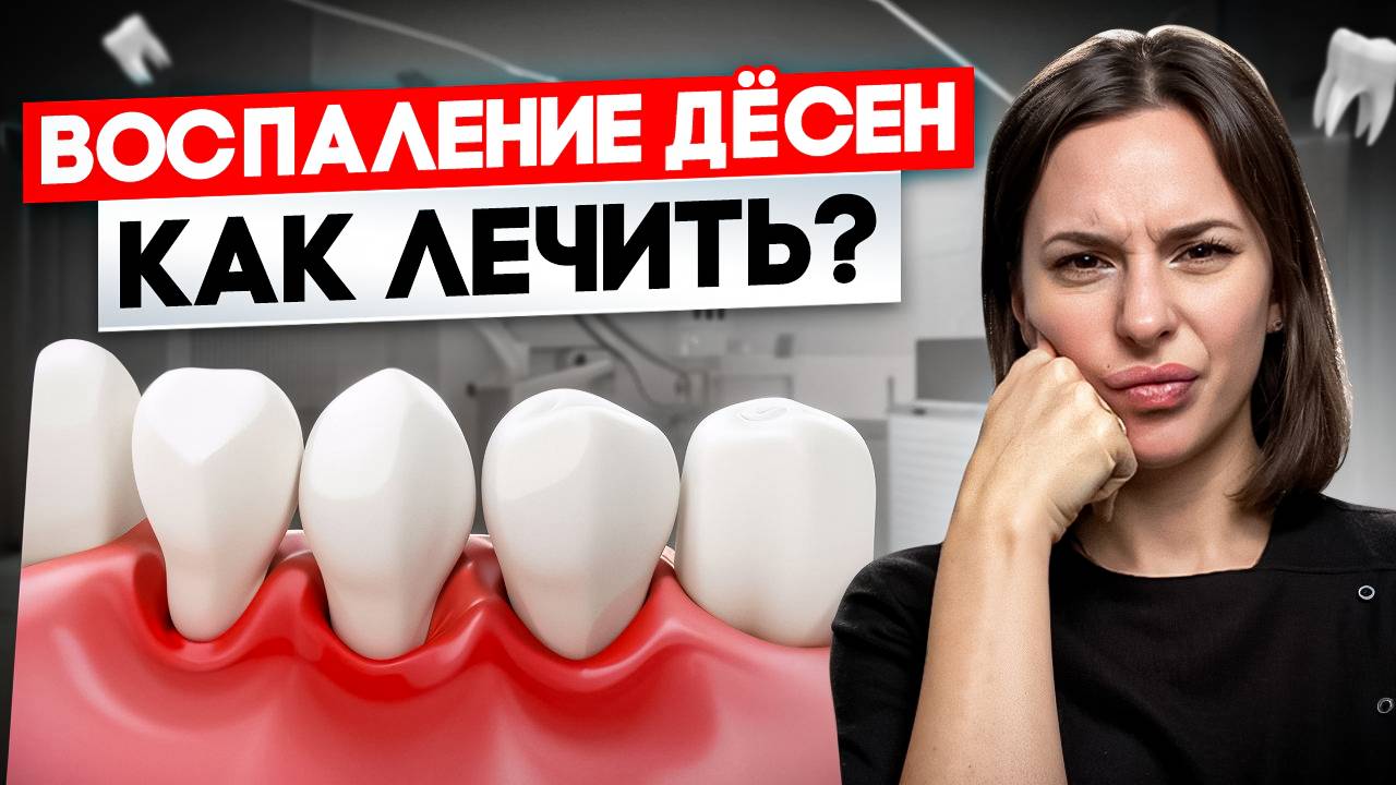 ЭТО ПОМОЖЕТ! Воспаление десны, гингивит и пародонтит | Как быть если кровоточат десна