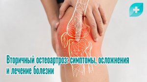 Вторичный остеоартроз: симптомы, осложнения и лечение болезни