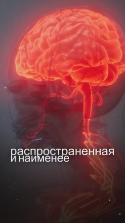 Сотрясение Мозга у Детей: Как Распознать и Что Делать в Первые Часы?