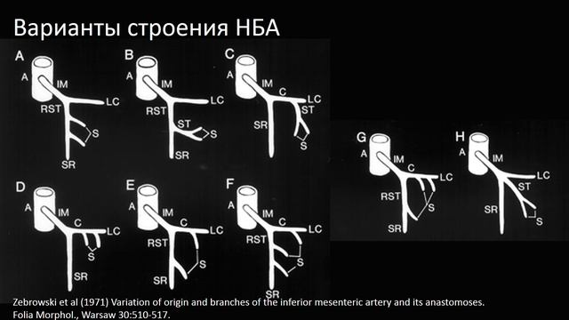 ЛД в онкологии. Часть 1 13. Лекция «Опухоли ободочной кишки»(1)