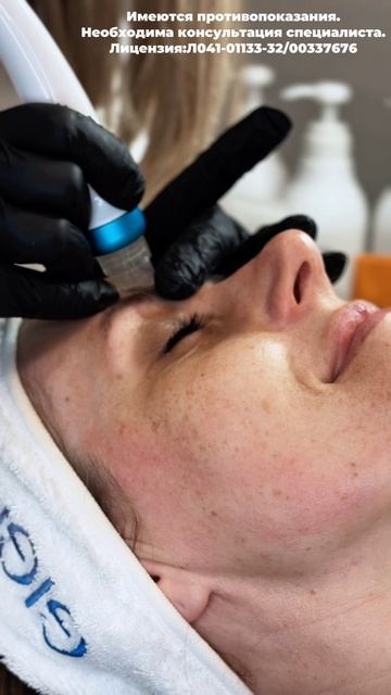 Модная Цирюльня Брянск 
HYDRAFACIAL на аппарате HYDRA BEAUTY