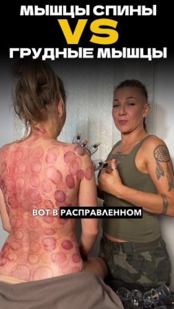 Почему важно ставить банки только на спину?