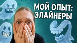 МОЙ ОПЫТ НОШЕНИЯ ЭЛАЙНЕРОВ