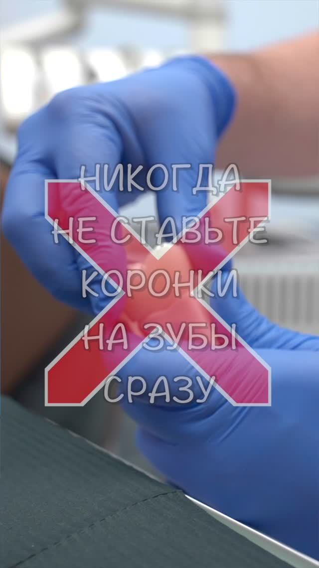 Правильная установка зубных коронок — ZemsClinic.ru #shorts #стоматологиямосква #лечениезубов