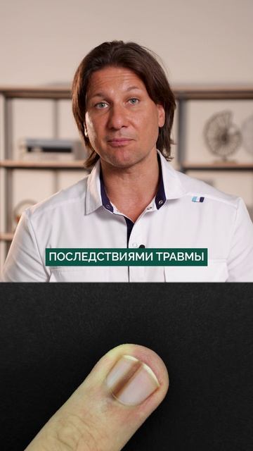 СРОЧНО посмотрите на свои ногти! #организм #здоровье #ногти
