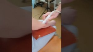 Осмотр локтевого сустава #узи #shorts #ultrasound