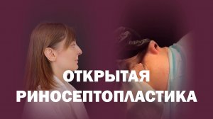 Минус горбинка, плюс гармония: открытая рино у Репиной