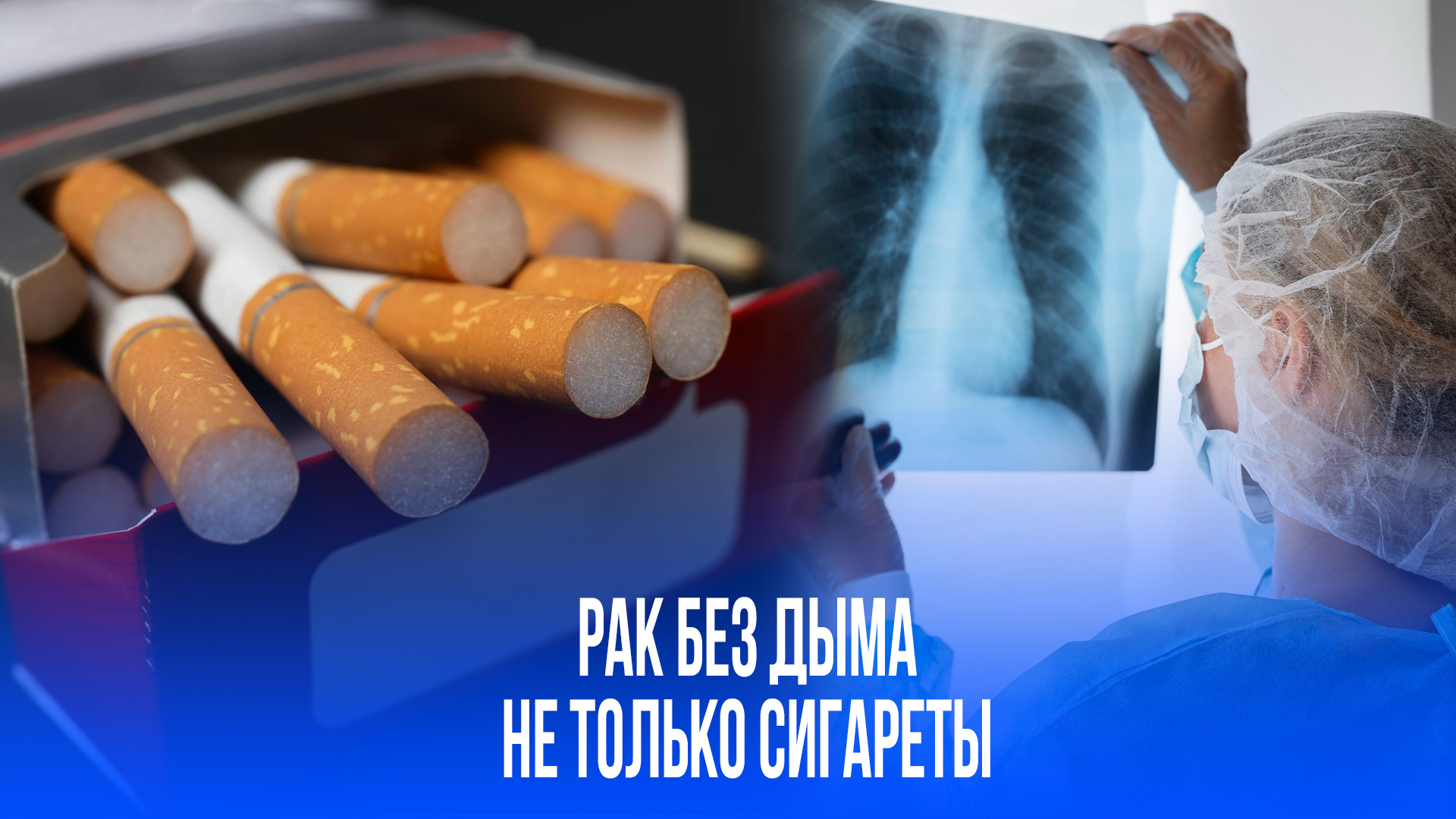 Врачи в шоке: Рак легких атакует некурящих! В чём коварный секрет?