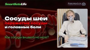 Сосуды шеи
