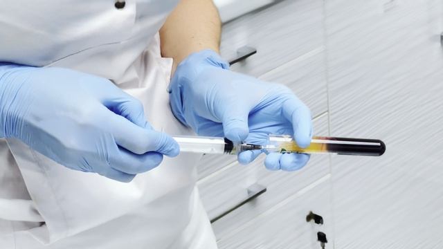 Плазмолифтинг смотреть онлайн