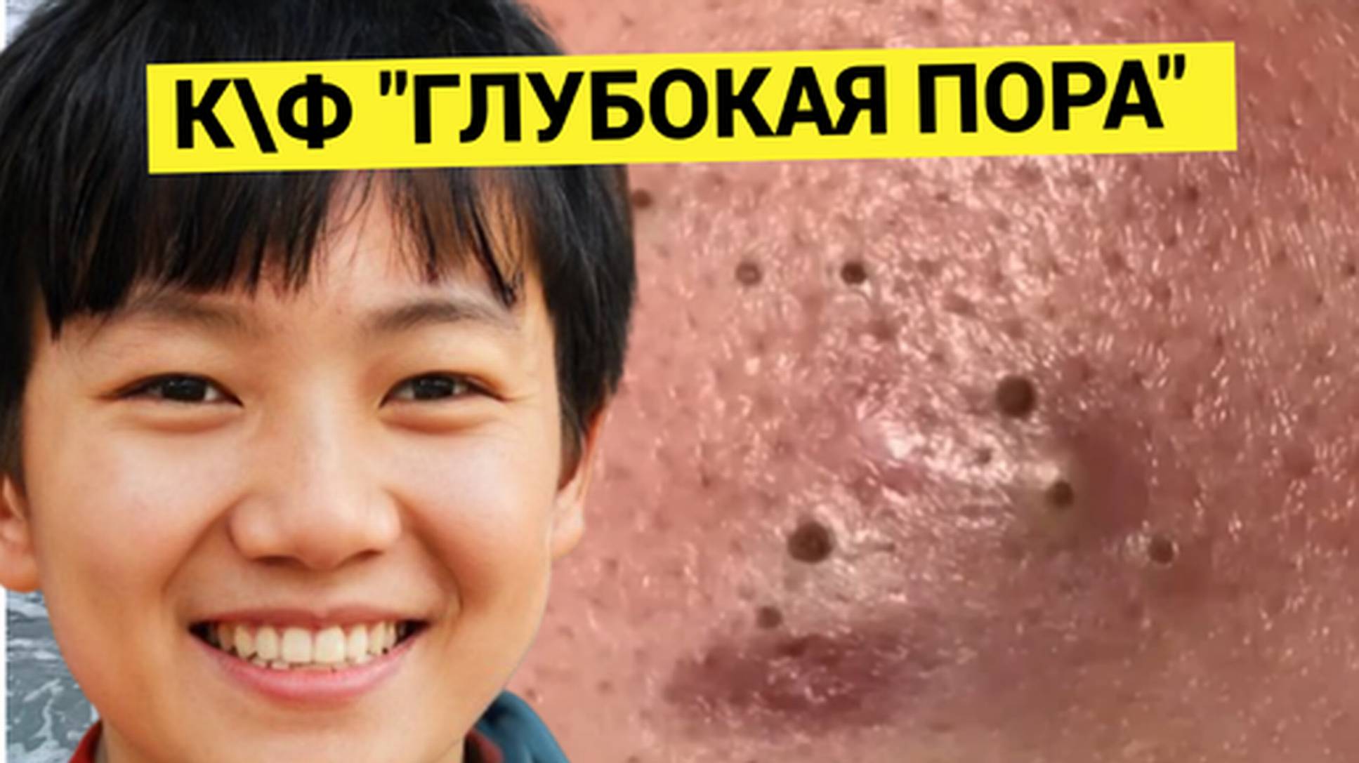 ГЛУБОКАЯ Пора Чистка Кожи Лица