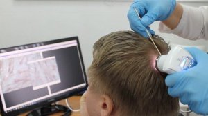 Трихоскопия