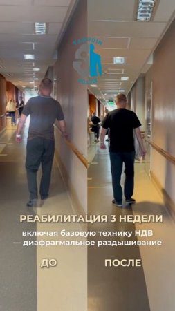 Результаты реабилитации после инсульта