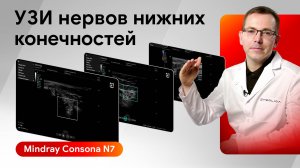 Мастер-класс по УЗИ нервов нижних конечностей на Mindray Consona N7