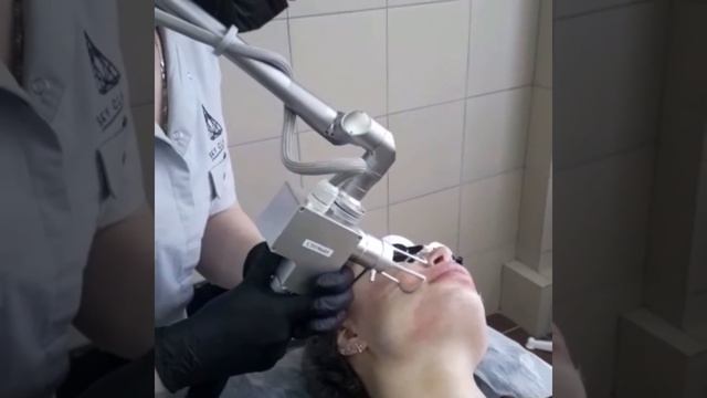 ФРАКЦИОННЫЙ СО2-ЛАЗЕР