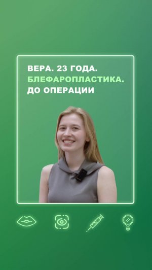 Вера. 23 года. Блефаропластика. До операции
