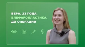 Вера. 23 года. Блефаропластика. До операции