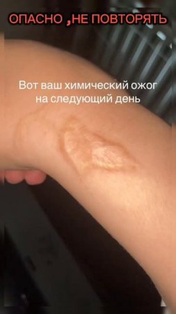 Не повторять! #опасно #зумеры #идиот #россия #shortvideo #shorts #video #бойцовскийклуб #ожоги #2025