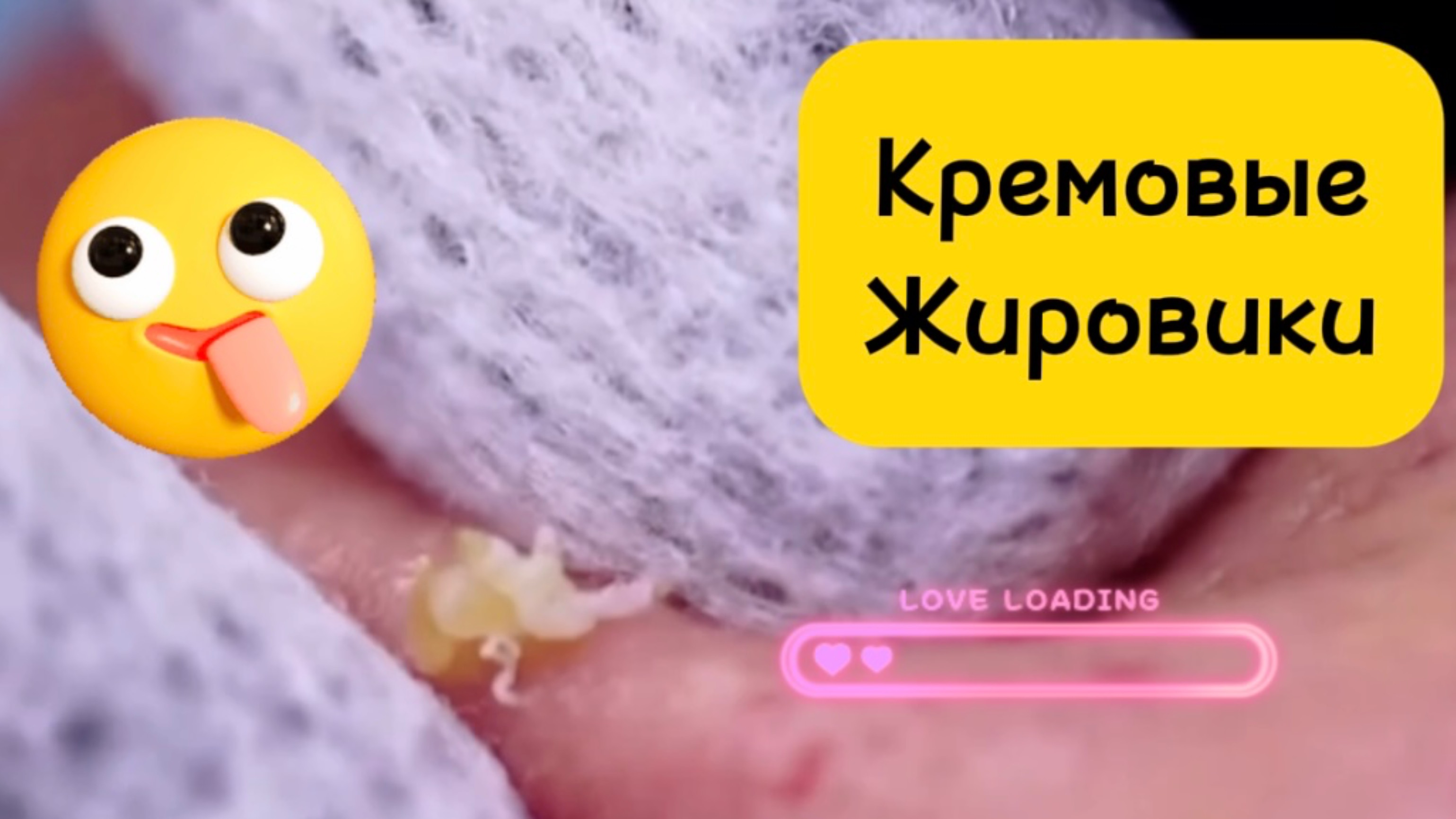 Очистка лица от угрей и акне.
Выдавливание прыщей. Удаление черных точек и комедонов.