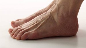 Флеболог назвал первые симптомы варикоза