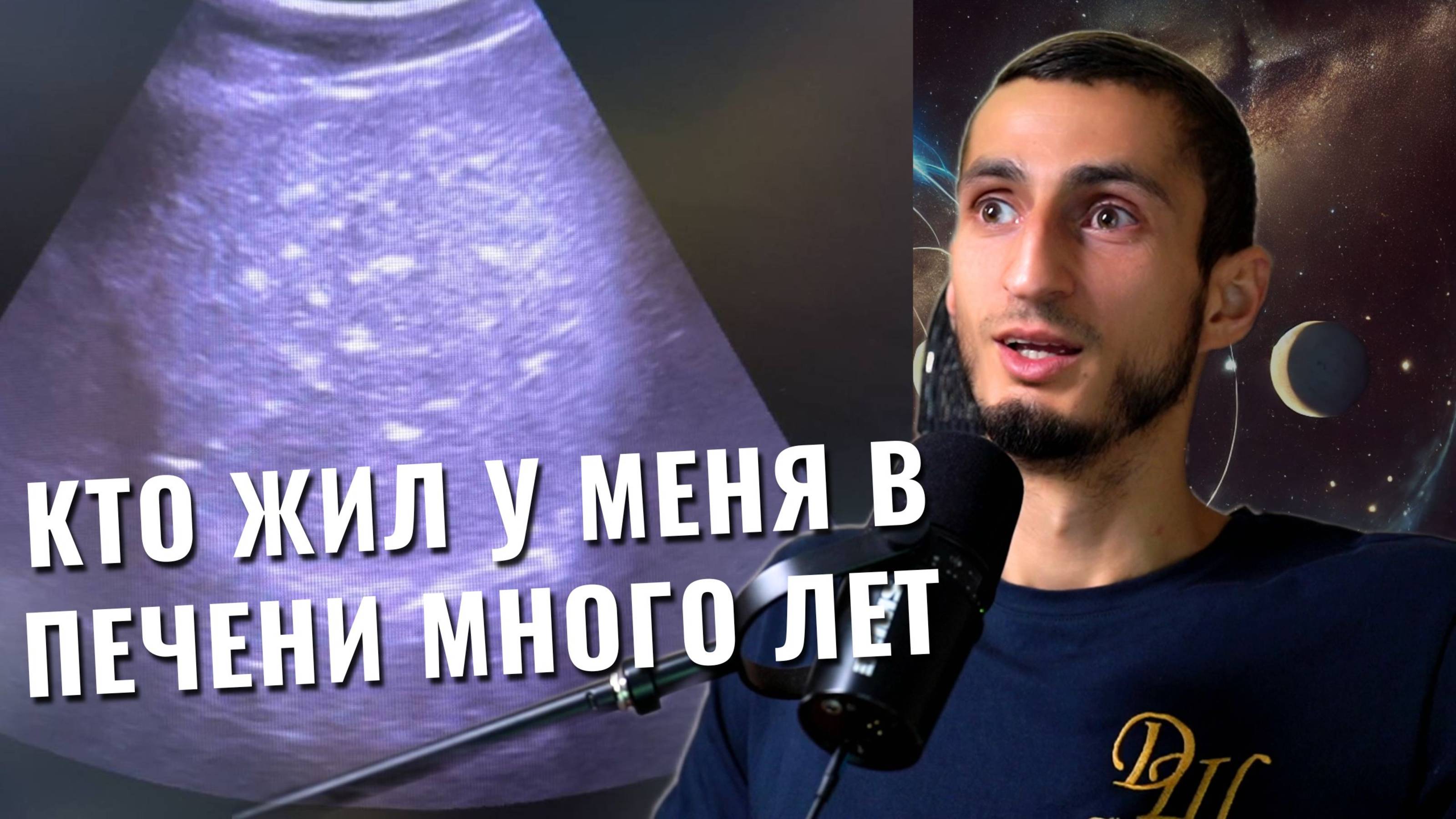 Паразиты передаются даже через ПОЦЕЛУЙ! Что я увидел в печени после АНТИпаразитарной чистки
