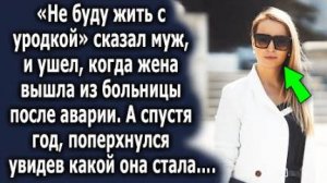-Не буду жить с уродкой, - сказал муж и ушел, когда жена вышла из больницы после аварии. А спустя...