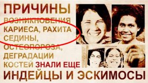 ⚡ Причина КАРИЕСА, седина, кривые ЗУБЫ ...