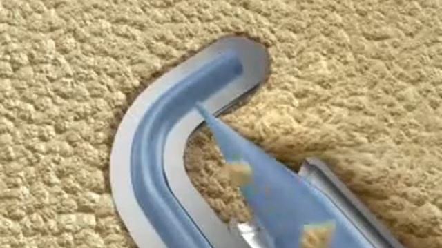 Microdiscectomy
