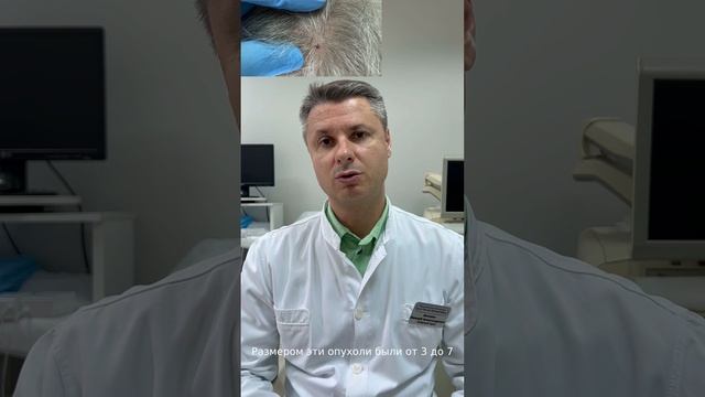 Красные родинки. Гемангиомы