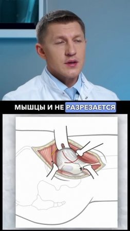 Пожизненные ограничения после эндопротезирования тазобедренного сустава.