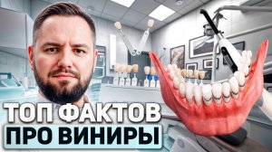 ТОП фактов про ВИНИРЫ