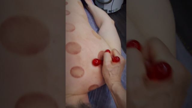 массаж спины и вакуумная терапия