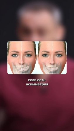 Главная проблема при работе с челюстью