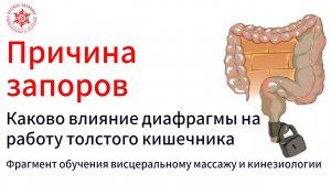 Причина запоров. Каково влияние диафрагмы на работу толстого кишечника. Фрагмент обучения