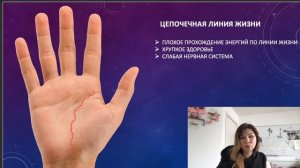 Типы линии жизни.
