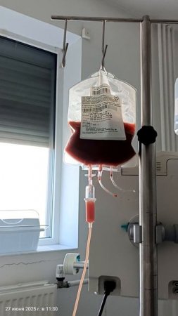 Провели трансплантацию. Внутривенно влили клетки донора. Теперь только ждать....mp4