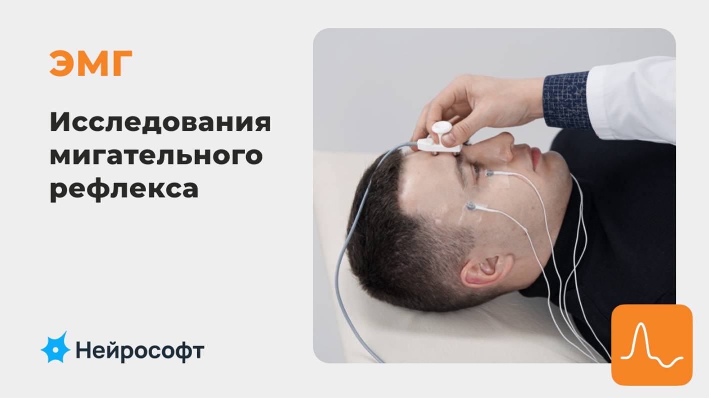 ЭМГ: методика исследования мигательного рефлекса