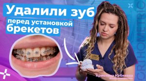 Секреты идеальной улыбки с брекетами Orthometric
