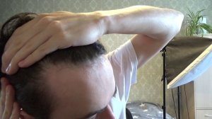 ЭТО ОБЛЫСЕНИЕ?