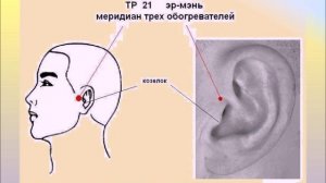 Шум в Ухе. Гирудотерапия поможет. Врач невролог, рефлексотерапевт Т.А. Шерефли