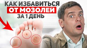 3 действия НАВСЕГДА избавят от НАТОПТЫШЕЙ и СТРЕЖНЕВЫХ МАЗОЛЕЙ!