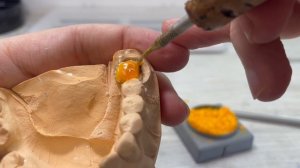 Изготовление культевой вкладки из металла