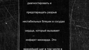 ИИ помогает кузбасским ученым-кардиологам спасать жизни
