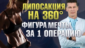 Чем липосакция 360 лучше обычной? Реальные результаты липосакции до после / Липомоделирование тела