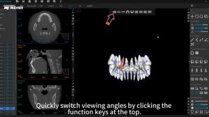 MEC ‑ Tooth Segmentation and Application