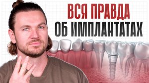 ВЕЧНЫЕ имплантаты: МИФ или РЕАЛЬНОСТЬ? / Советы от опытного стоматолога