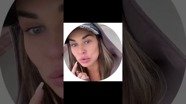 Иришка все мучается с зубами и никак не может достичь улыбки мечты 👀