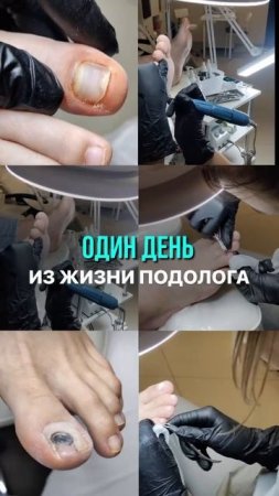 👉 ВНИМАНИЕ! Плесень в деле! 🧟♀️