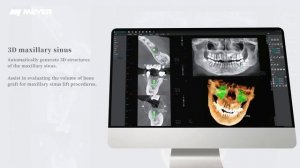 CBCT NEW NEW Presentation