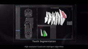 Meyer High-End CBCT Product Video